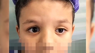 پتوز مینیمال