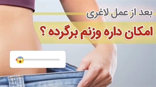 بعد از عمل لاغری امکان داره وزنم برگرده ؟