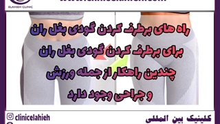 تزریق فیلر جراحی لثه