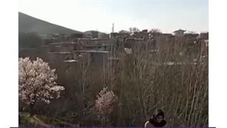 تعویض دو طرفه مفصل ران