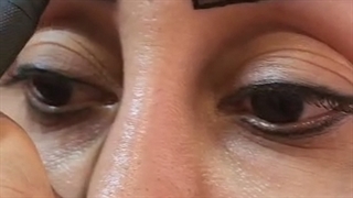 رضایت کاشت ابرو