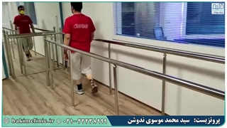 پروتز زیر زانو با پنجه کربنی و سیلیکون لاینر-کلینیک ارتوپدی فنی حکیم