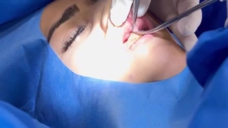 جراحی فرنکتومی