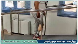 پروتز زیر زانو با پنجه کربنی پارس فلکس