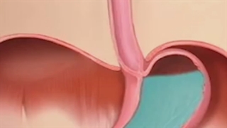 اهمیت نوشیدن آب بر دیسک کمر