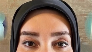 ک ماه بعد از عمل جراحی