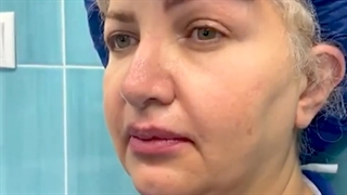 عمل کل صورت و گردن و لیفت اندوسکوپیک ابرو