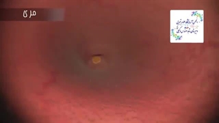 چگونه بدن غذا را به مدفوع تبدیل می کند ! به وبلاگ ما سر بزنین http://azmavakili.blogfa.com/