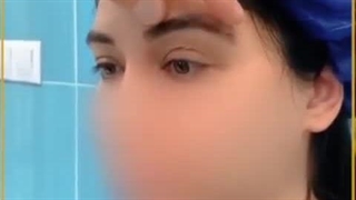 عمل زیبایی لیفت ابرو