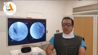 کنسر پانکراس