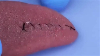 روش تمرین کردن بخیه زدن و جراحی بر روی میوه و وسایل با آنی حامی Ani Hami