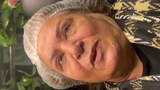 آموزش ریموو ابرو با جدیدترین تکنیک پاک کردن تاتو