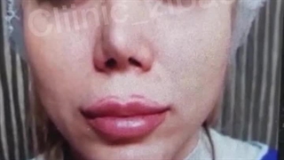 یک هفته بعد از لیفت سانترال لب