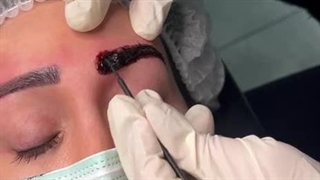 نیلوفر کاظمی با بیشترین تخصص در ریموو تاتو