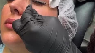 ریموو تاتو ابرو در یک جلسه بدون دوران نقاهت