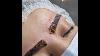 ریموت تتو جلسه دوم