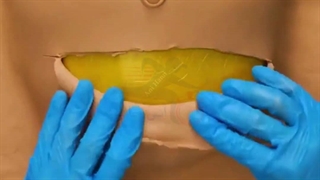 آموزش های گام به گام جراحی های پزشکی با آنی حامی Ani Hami