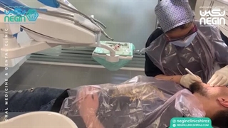 درمان ضایعه دهانی با استفاده از لیزر درمانی | کلینیک دهان پزشکی نگین شیراز اصلاح فرم صورت