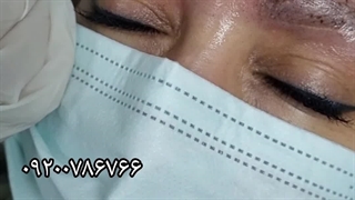 ریموتاتو پوست حساس