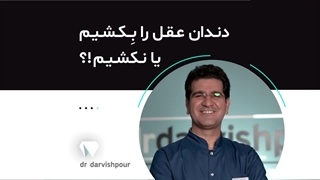 دندان عقل را بکشیم یا نکشیم؟