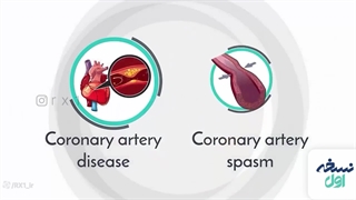 تفاوت نارسایی قلبی با حمله قلبی - داروخانه آنلای نسخه اول - داروخانه اینترنتی نسخه اول