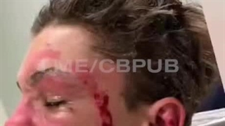 نمیدونم چی بگم•__•