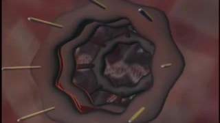 پیش پرده 6 مدهوش کننده