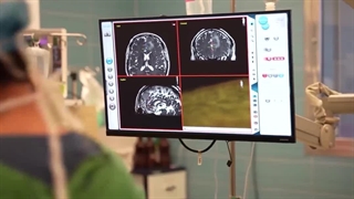 جراحی تومور مغزی و مراحل بهبود بیمار