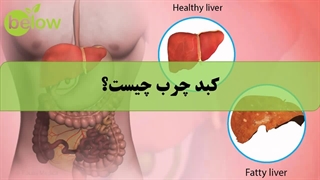 کبد چرب چیست؟