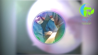 آرتروسکوپی و تایید پارگی ACL