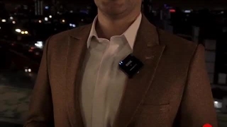 کاشت مو به روش FUT و خدمات لاغری توسط دکترکامران دلیر