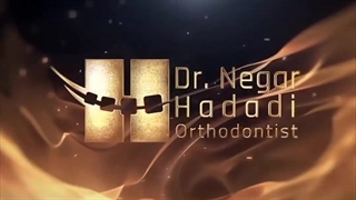 ارتودنسی دندان بزرگسالان