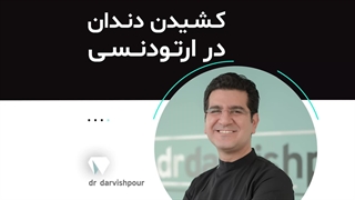 کشیدن دندان در ارتودنسی