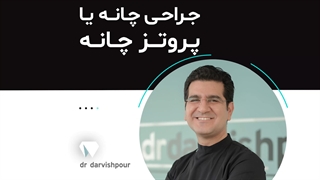 جراحی چانه یا پروتز چانه؟ آکنه