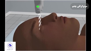 سونوگرافی چشم