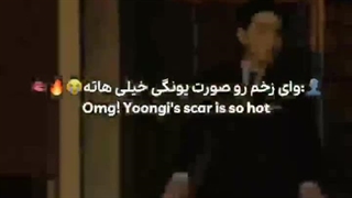 داستان پشت زخم صورت یونگی