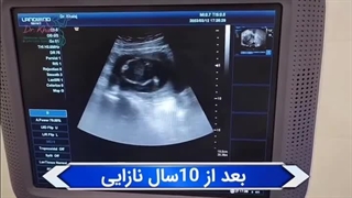 بارداری بعد از 10 سال انتظار با دکتر زهرا خلج