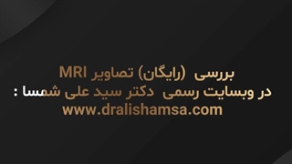 دکتر سید علی شمسا آر اف فرکشنال