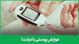 عوارض پوستی با دیابت!