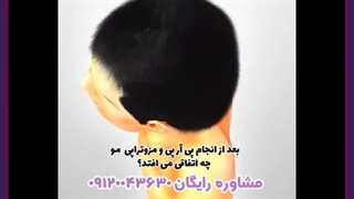 مزوتراپی صورت چیست لمینت