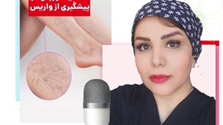 اهمیت ورزش در پیشگیری از واریس