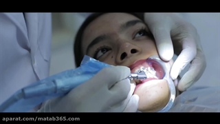 متخصص ارتودنسی در اصفهان | دکتر محمدعلی ناصری برداشتن خال