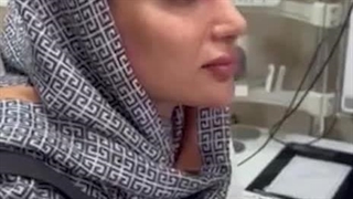 نمونه کار عمل بینی در شیراز | دکتر مسعود جانی پور