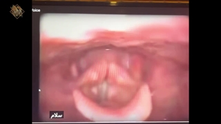 ویدیوی عملکرد تارهای صوتی | کافه آواز | مهدی هدایی