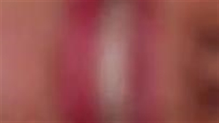 لمینت و کامپوزیت خوب در مشهد دکتر وکیلی-360p