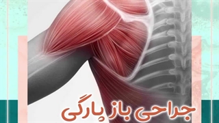 جراحی باز پارگی تاندون شانه | دکتر طاهریان