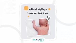 درماتیت کودکان - داروخانه آنلاین نسخه اول - داروخانه اینترنتی نسخه اول