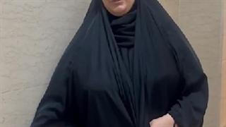 رضایت بیمار از جراحی استرابیسم چشم