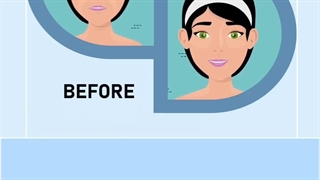 دستگاه لیزر کیوسوئیچ