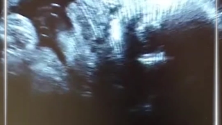 فیلم دو بعدی و چهار بعدی جنین